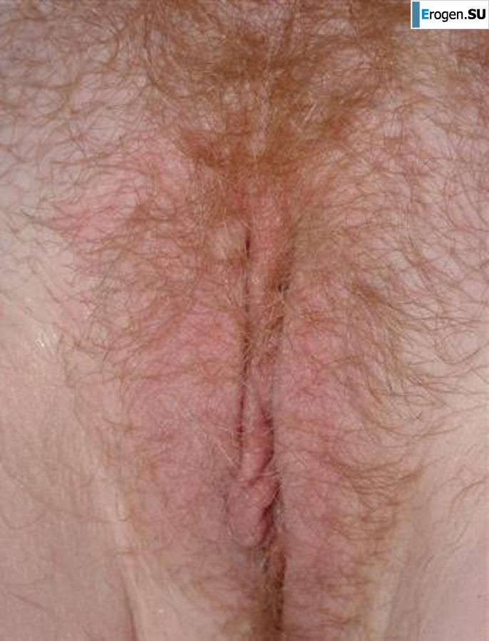 Solyanka. Part 24. Photo 39