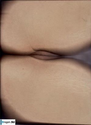 nitsche so. Thumb 29