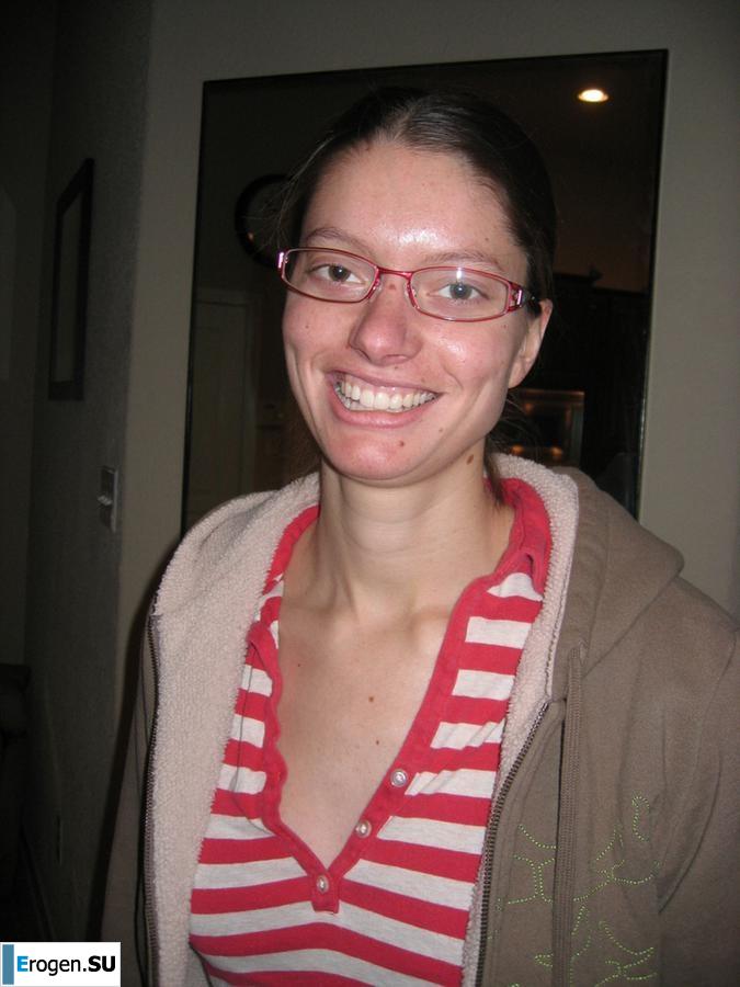 On the face of a terrible, kind inside. Photo 16