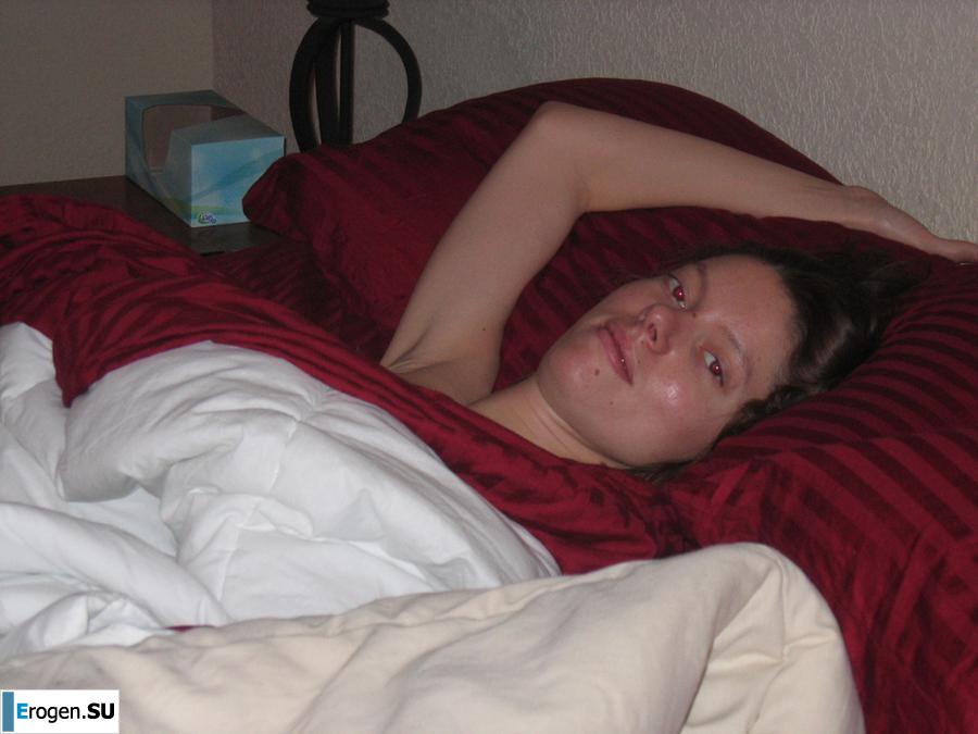 On the face of a terrible, kind inside. Photo 18