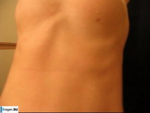 Terrible on the face, kind inside. Part 8. Thumb 34