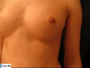 Terrible on the face, kind inside. Part 8. Thumb 4