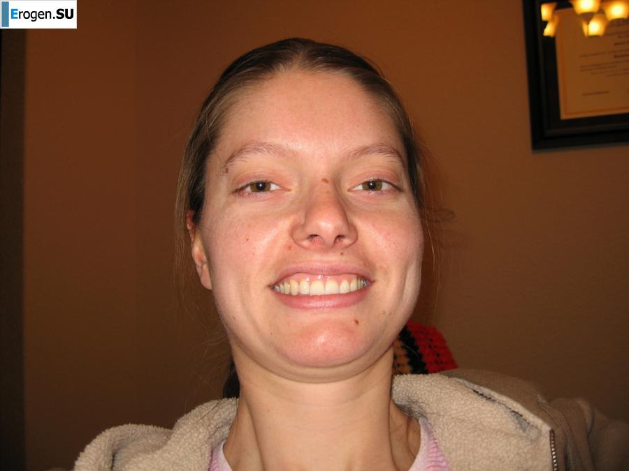 On the face of a terrible, kind inside. Part 9. Photo 11