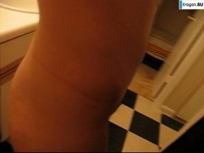 On a terrible face, kind inside. Part 11. Thumb 15