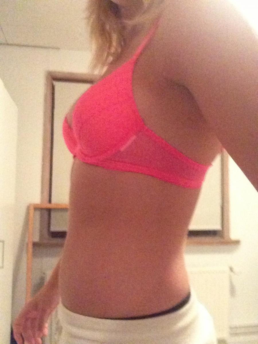 Acne selfie. Photo 14