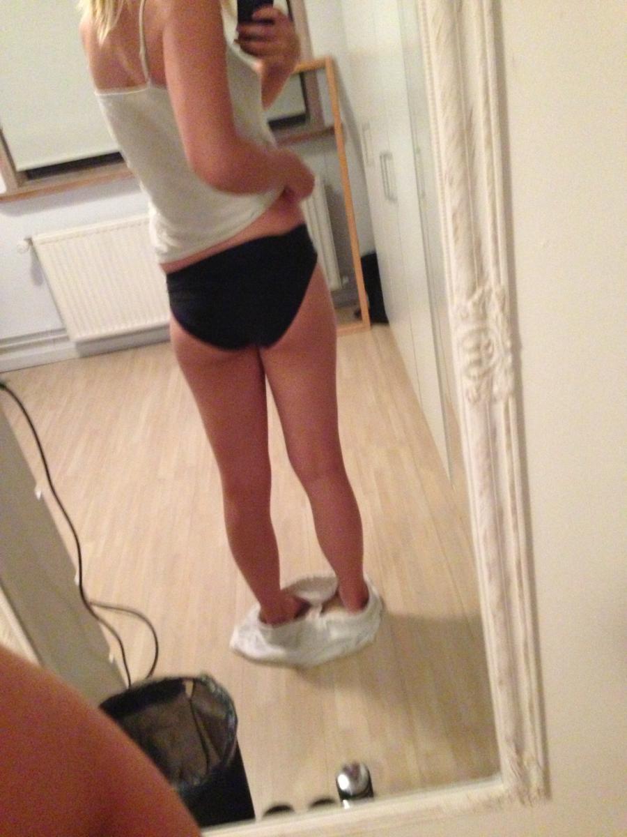 Acne selfie. Photo 18