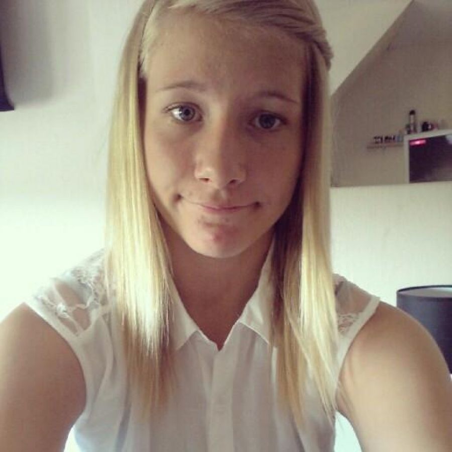 Acne selfie. Photo 24