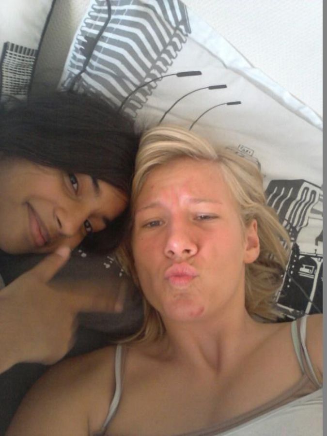 Acne selfie. Photo 27