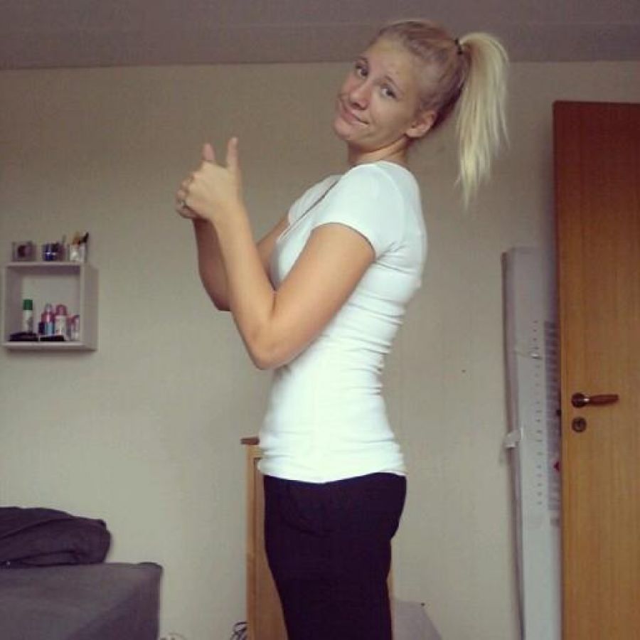 Acne selfie. Photo 28