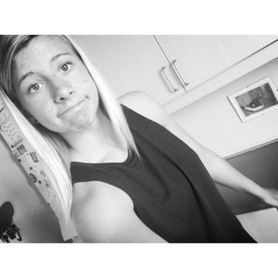 Acne selfie. Photo 3