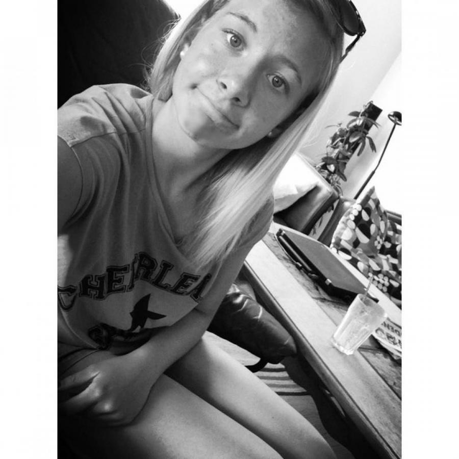 Acne selfie. Photo 38