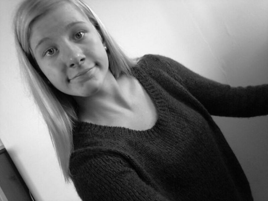 Acne selfie. Photo 5