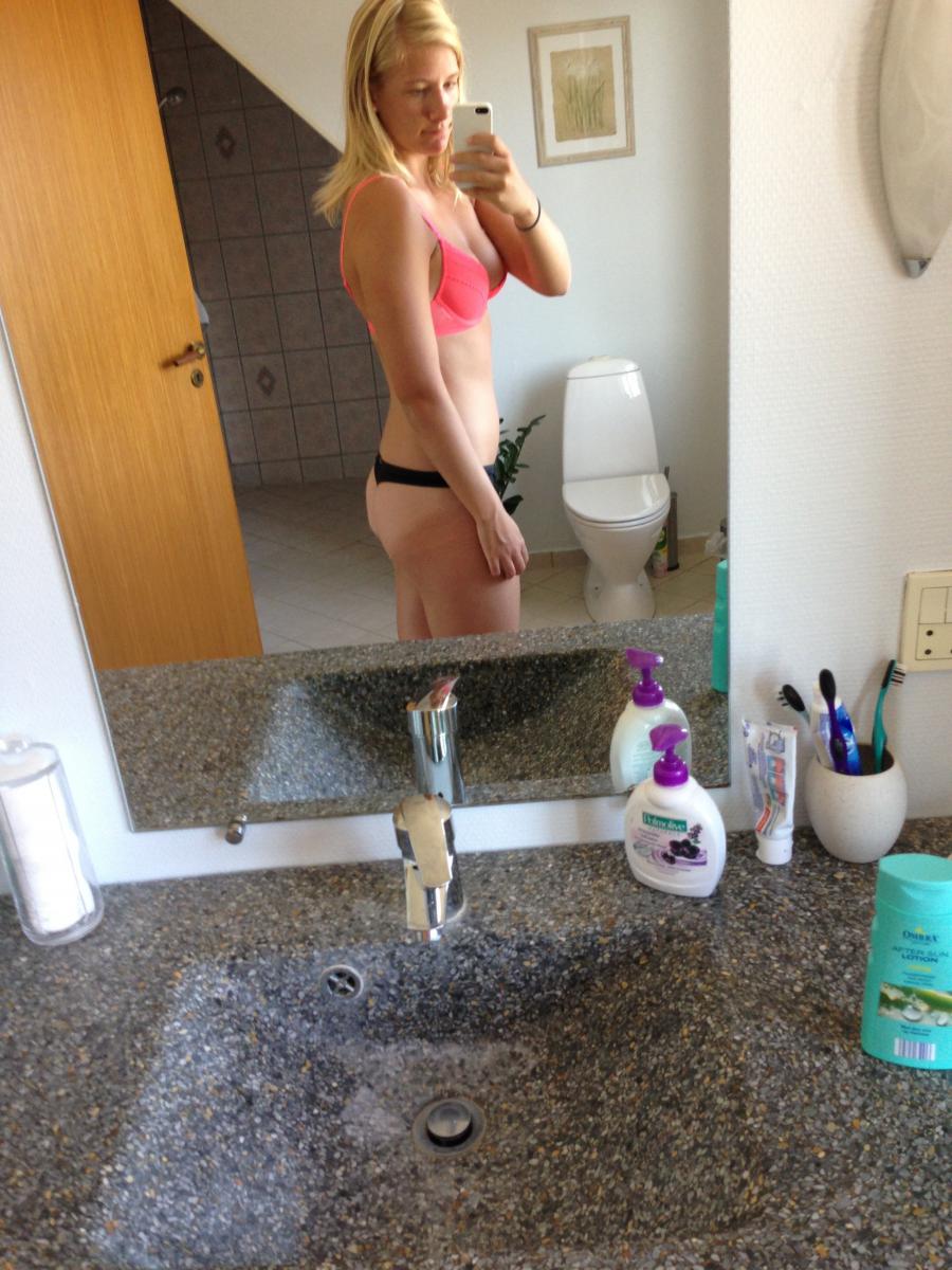 Acne selfie. Photo 7