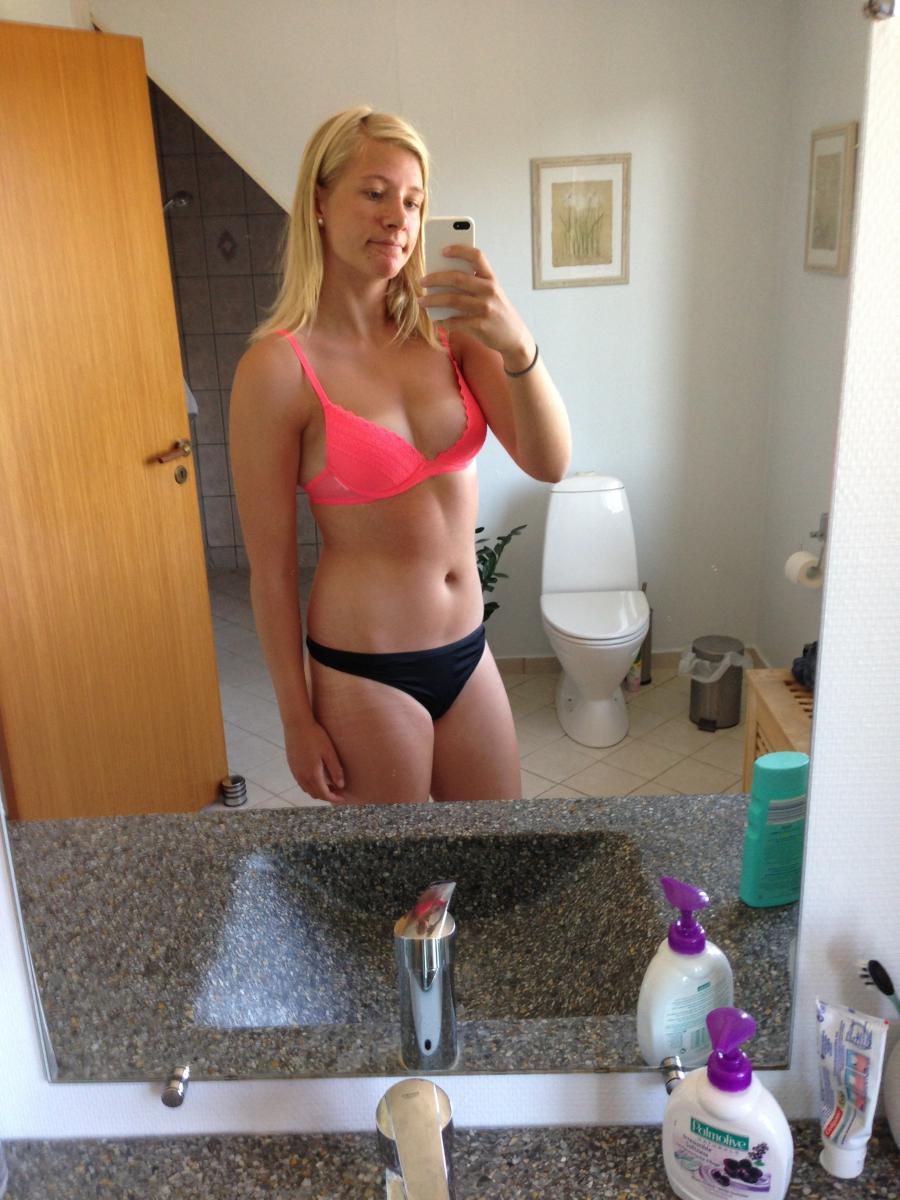 Acne selfie. Photo 8