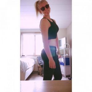 Acne selfie. Thumb 10