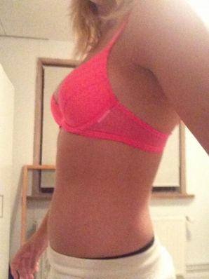 Acne selfie. Thumb 14