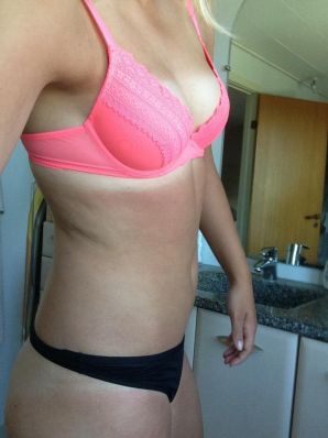 Acne selfie. Thumb 22