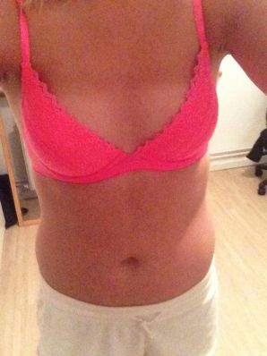 Acne selfie. Thumb 30