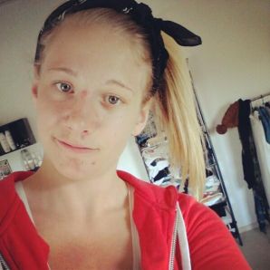 Acne selfie. Thumb 6