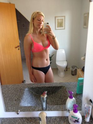 Acne selfie. Thumb 8