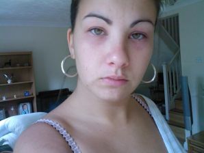 Pierced green-eye. Part 3. Thumb 31