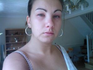 Pierced green-eye. Part 4. Thumb 12