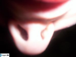 Dark-eyed Gray-Eye. Thumb 10