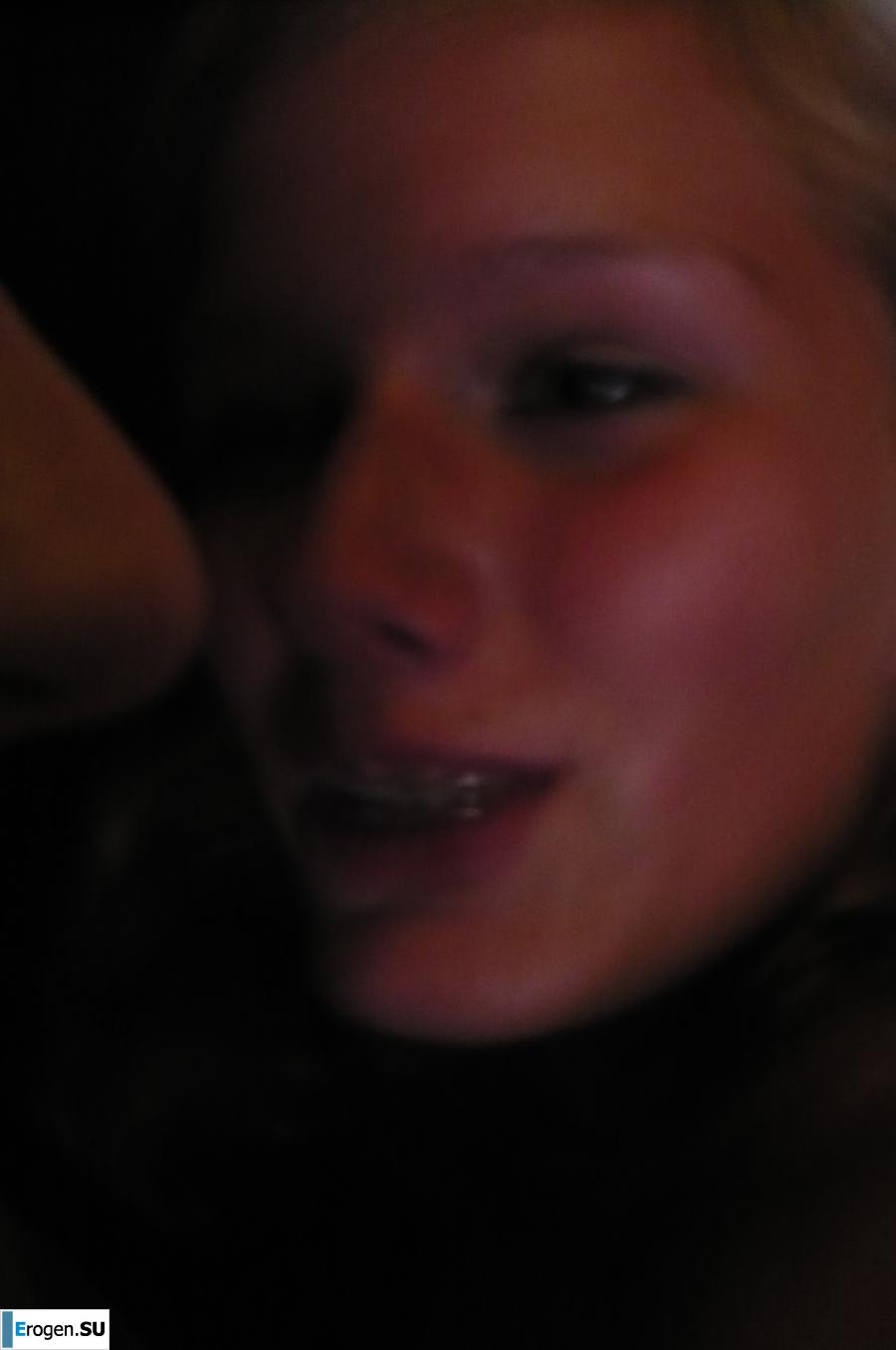 Redhead with braces. Photo 27