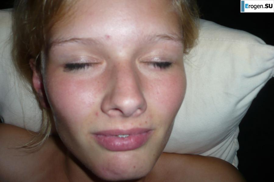 Redhead with braces. Photo 32