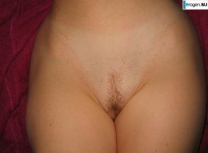 red-haired cauliflower slim woman. Thumb 36